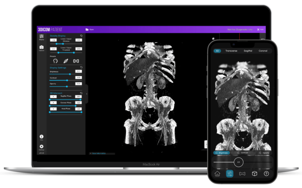 DICOM viewer iOS