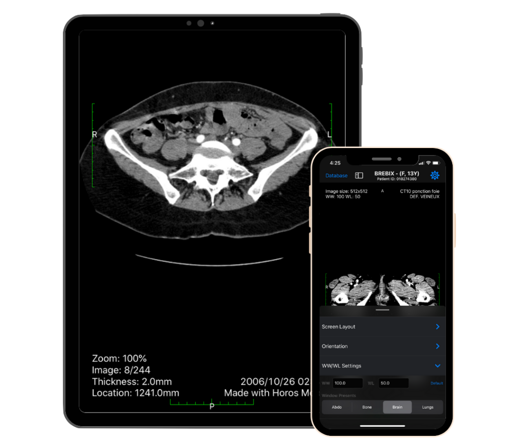 DICOM viewer iOS